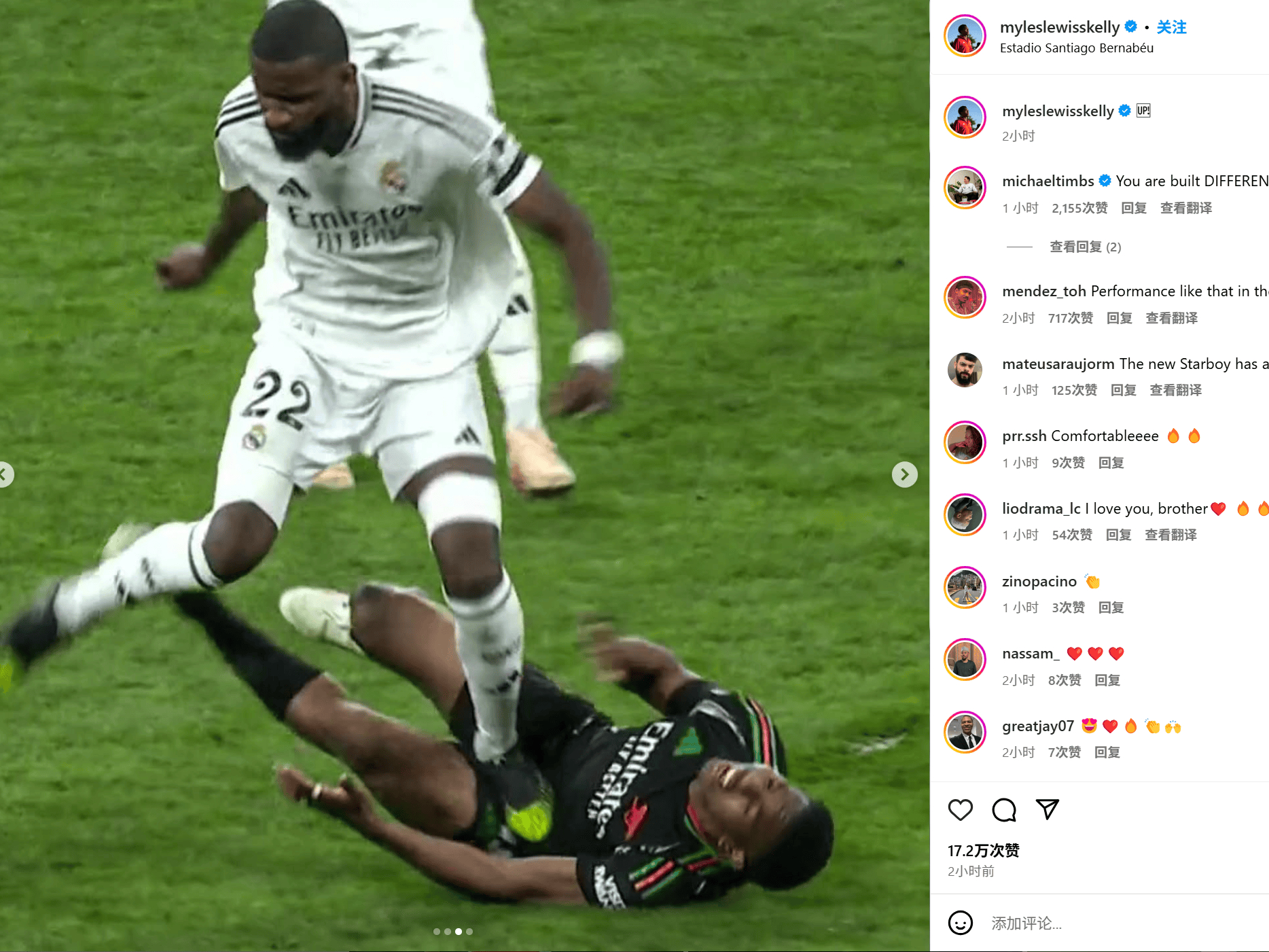 阿森纳后卫大卫松受伤缺席,球队难以击败热刺 阿森纳后卫大卫松受伤缺席,球队难以击败热刺